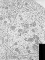 Prometaphase, group 1