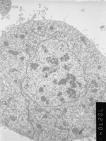 Prometaphase, group 1