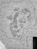 Prometaphase, group 2