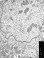 Prometaphase, group 3