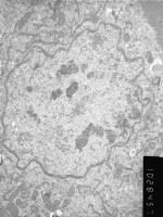 Prometaphase, group 3