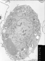 Prometaphase, group 3