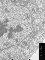 Prometaphase, group 3