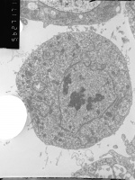 Prometaphase, group 3