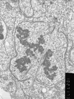 Prometaphase, group 3