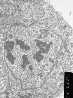 Prometaphase, group 3