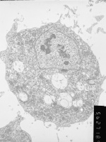 Prometaphase, group 3