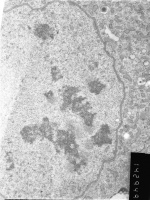 Prometaphase, group 1