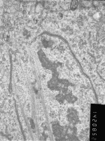 Prometaphase, group 2