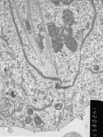 Prometaphase, group 2