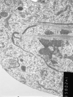 Prometaphase, group 2