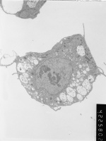 Prometaphase, group 1