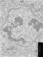 Prometaphase, group 3