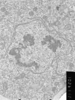 Prometaphase, group 3