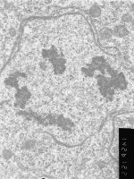 Prometaphase, group 3