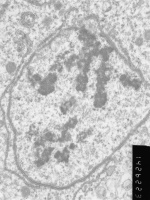 Prometaphase, group 2