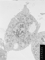 Prometaphase, group 2