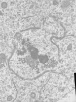 Prometaphase, group 3