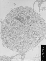 Prometaphase, group 3