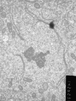 Prometaphase, group 3