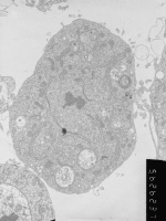 Prometaphase, group 3