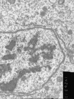 Prometaphase, group 2