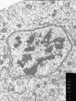 Prometaphase, group 2