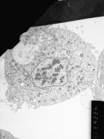 Prometaphase, group 2