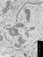 Prometaphase, group 2