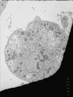 Prometaphase, group 2