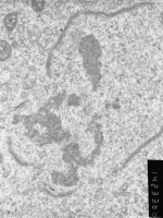 Prometaphase, group 2