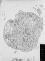 Prometaphase, group 2