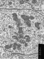 Prometaphase, group 3