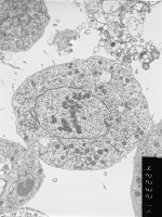 Prometaphase, group 3