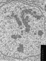 Prometaphase, group 3