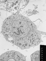 Prometaphase, group 3