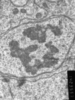 Prometaphase, group 3