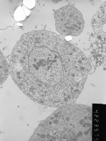 Prometaphase, group 3